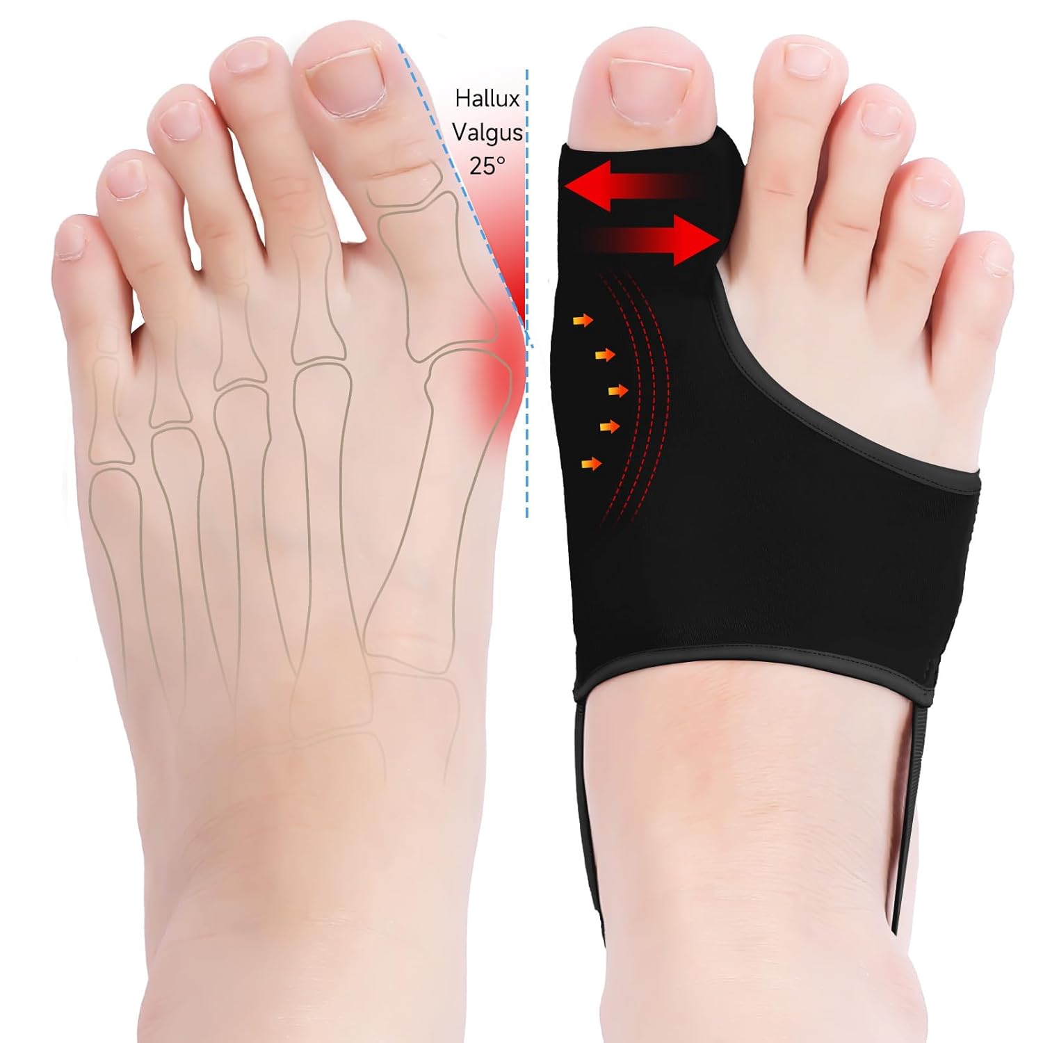 2PCS Bunion Correctors