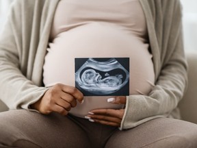Unrecognizable african american expecting woman holding sonogram - stock photo